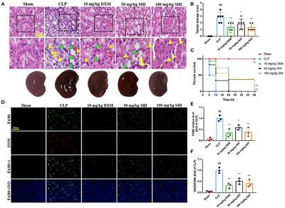 Shionone Attenuates Sepsis-Induced Acute Kidney Injury by Regulating Macrophage Polarization via the ECM1/STAT5 Pathway